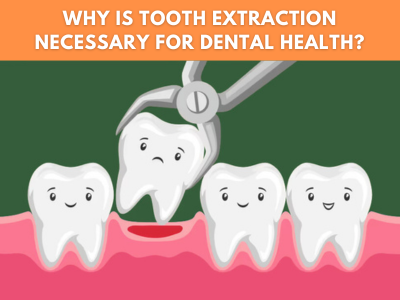 Tooth Extraction Dentist in Hesperia, CA