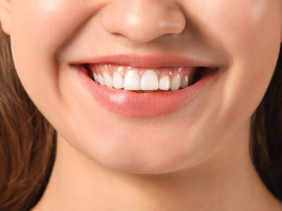 How to Maintain Healthy Gums – Maple Dental
