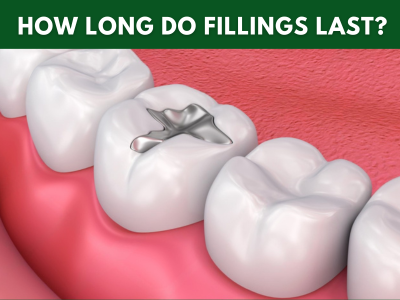 Dental filling at Maple Dental in Hesperia CA