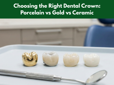 Types of Dental Crown