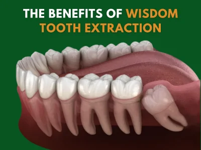 Wisdom Tooth Extraction