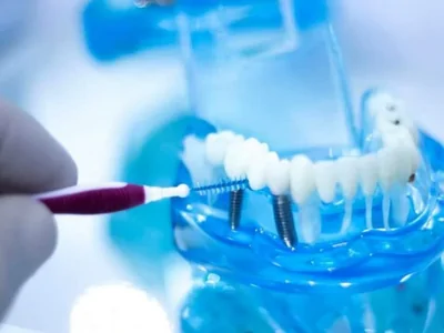 Dental Implant Dentists In Hesperia CA