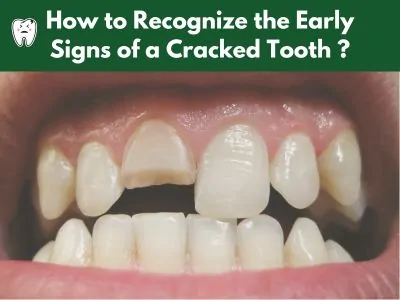 Cracked tooth symptoms you should know