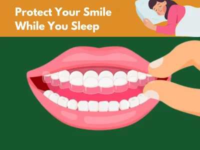 Custom night guard for teeth grinding