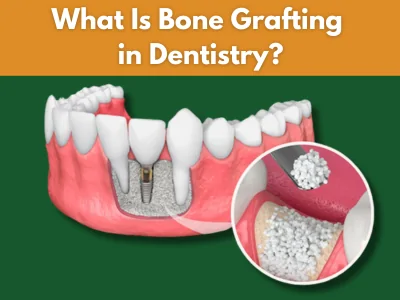 Dental bone graft procedure close-up