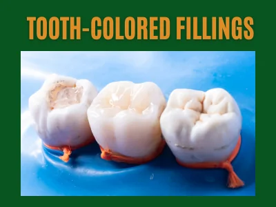 Tooth-Colored Fillings in Hesperia, CA