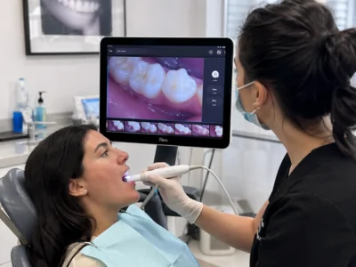 Intra Oral Camera in Hesperia CA | Maple Dental